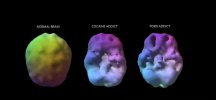 SPECT-scan-of-a-porn-addict-s-brain.jpg SPECT-scan-of-a-porn-addict-s-brain.jpg
